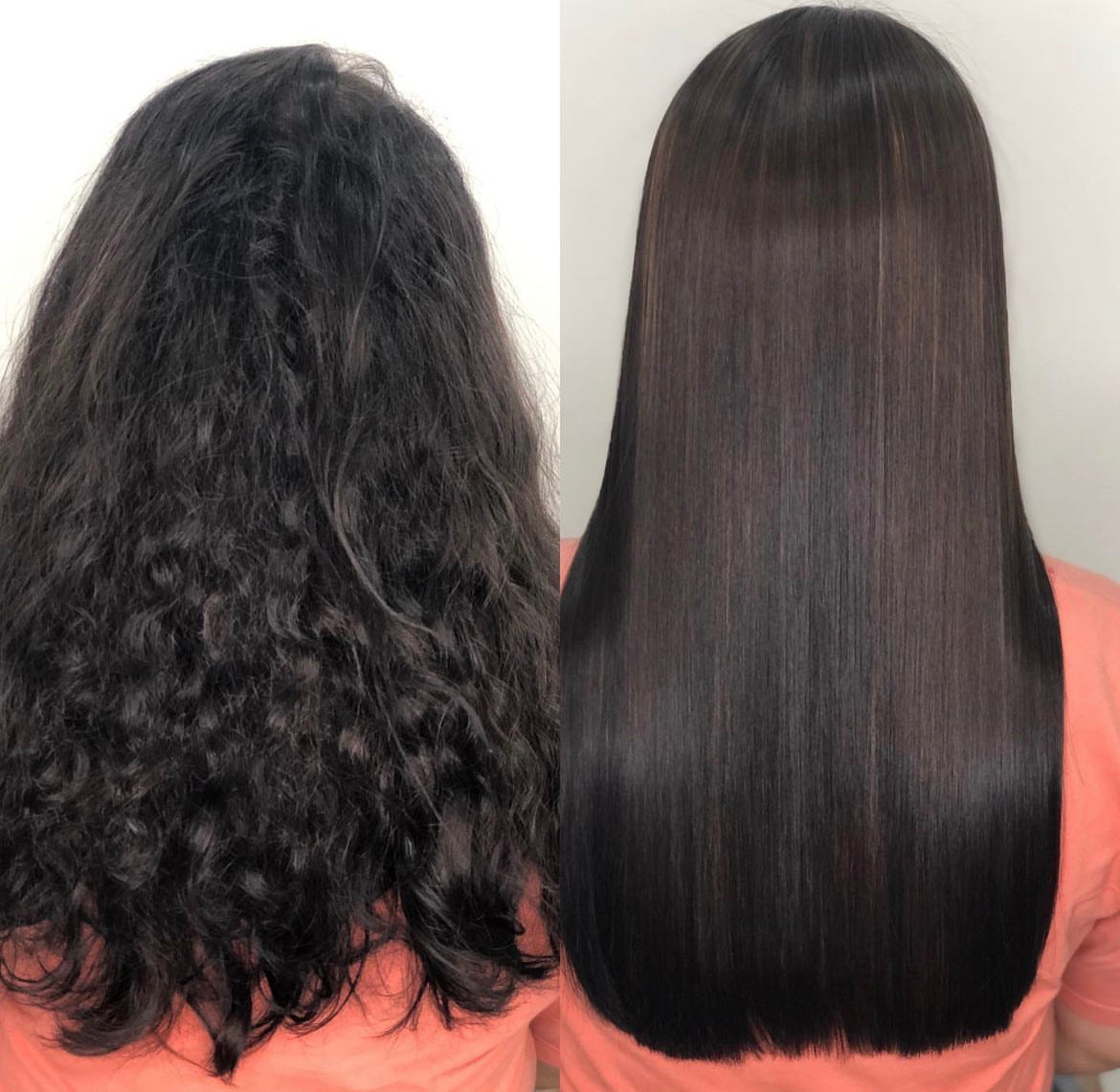 ENCODE STRAIGHTENING TREATMENT