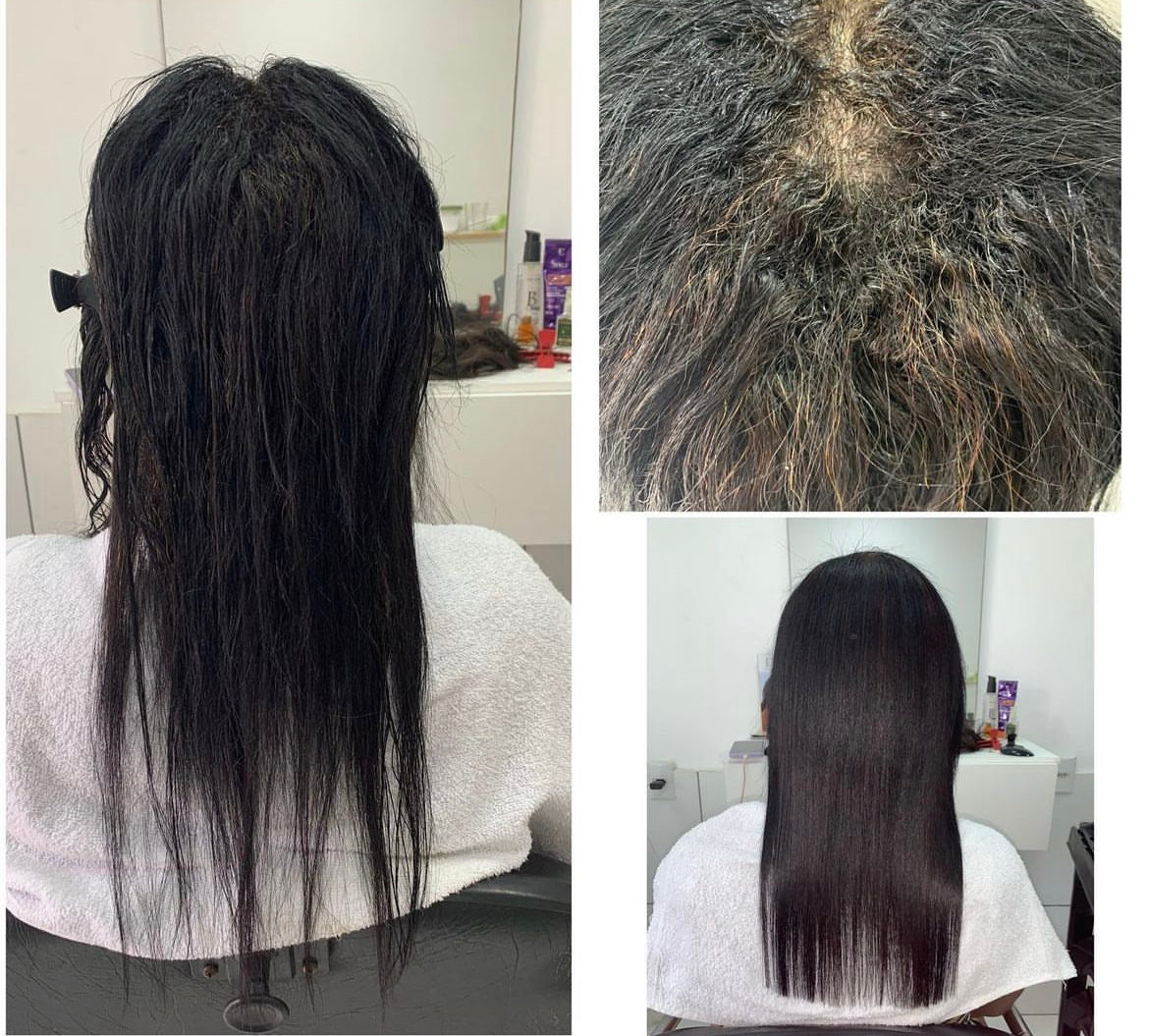 ENCODE STRAIGHTENING TREATMENT